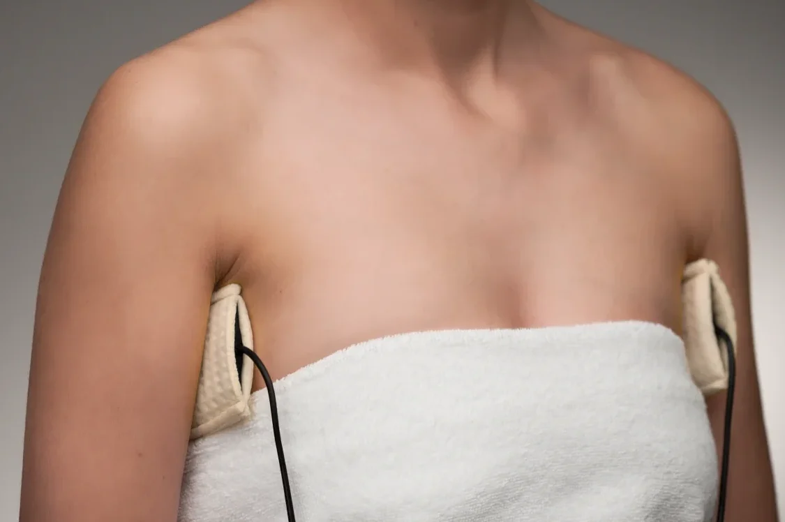 Reduktion des übermäßigen Schwitzens unter den Achseln mit der Saalio Leitungswasser-Iontophorese