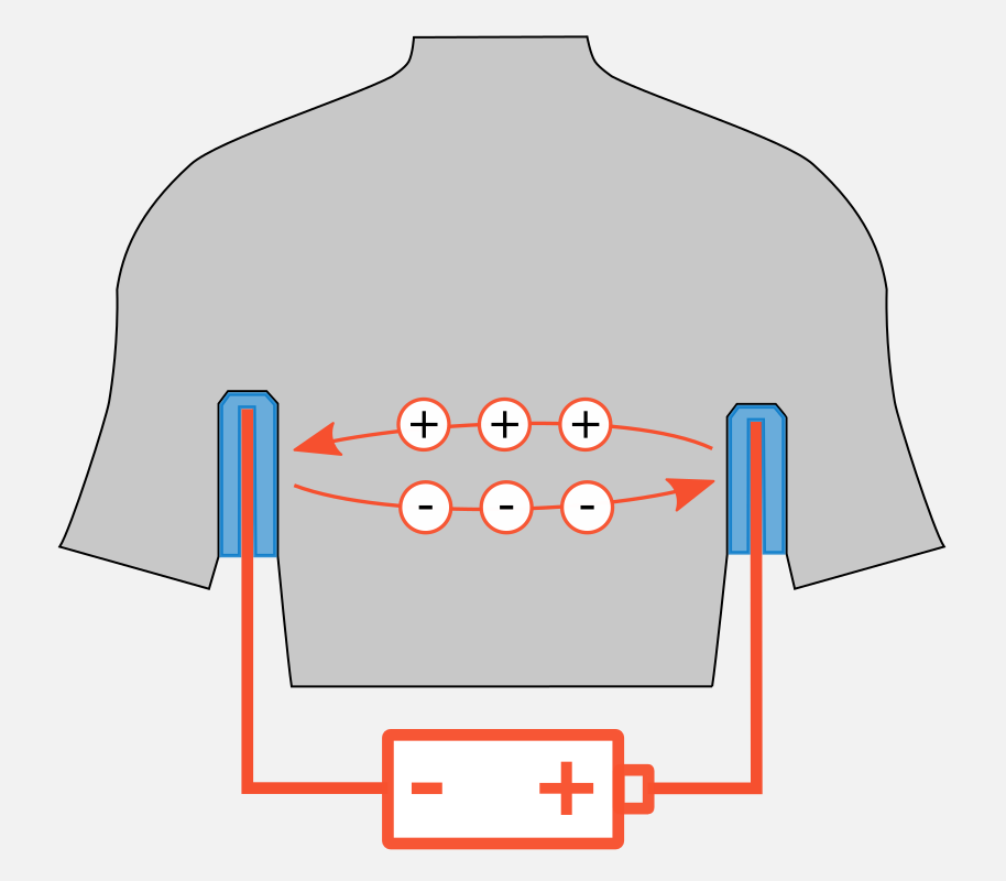 Leitungswasser-Iontophorese unter den Achseln einfach erklärt